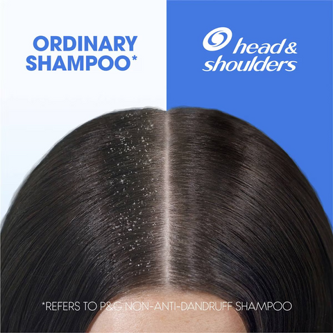 Head & Shoulders 2-in-1 Shampoo & Conditioner Clean & Balanced 750ml